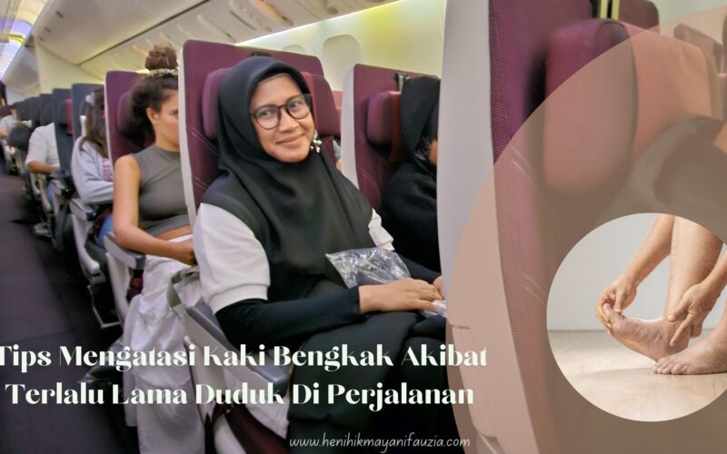 Mengatasi kaki bengkak akibat terlalu lama duduk di perjalanan